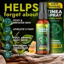 tinea-versicolor-treatment-antifungal-sp-2.jpg