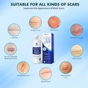rvlaim-silicone-scar-cream-scar-gel-scar-61+HPQa52HL.jpg