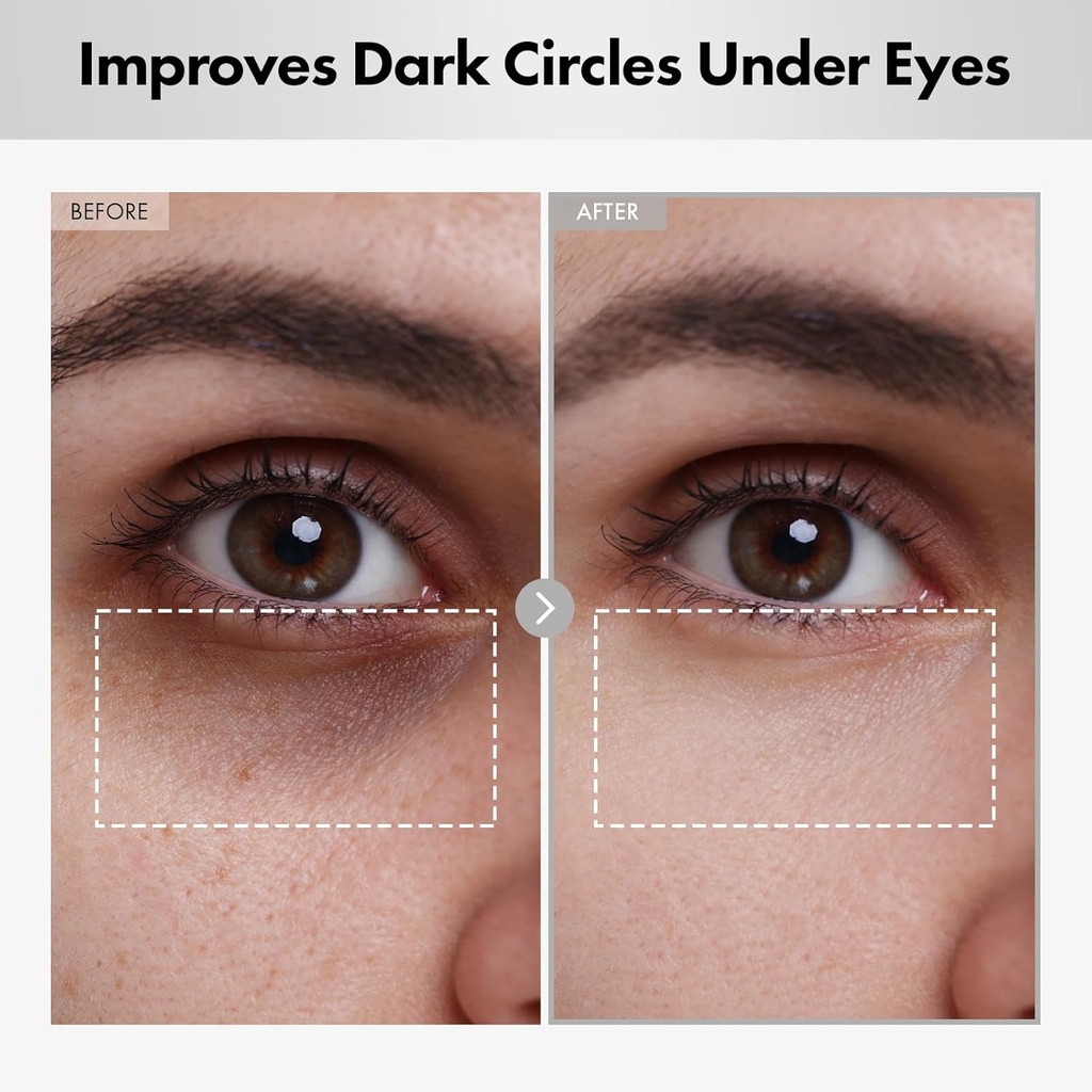 hyaluron-lifting-eye-cream-hyaluronic-ac-3.jpg