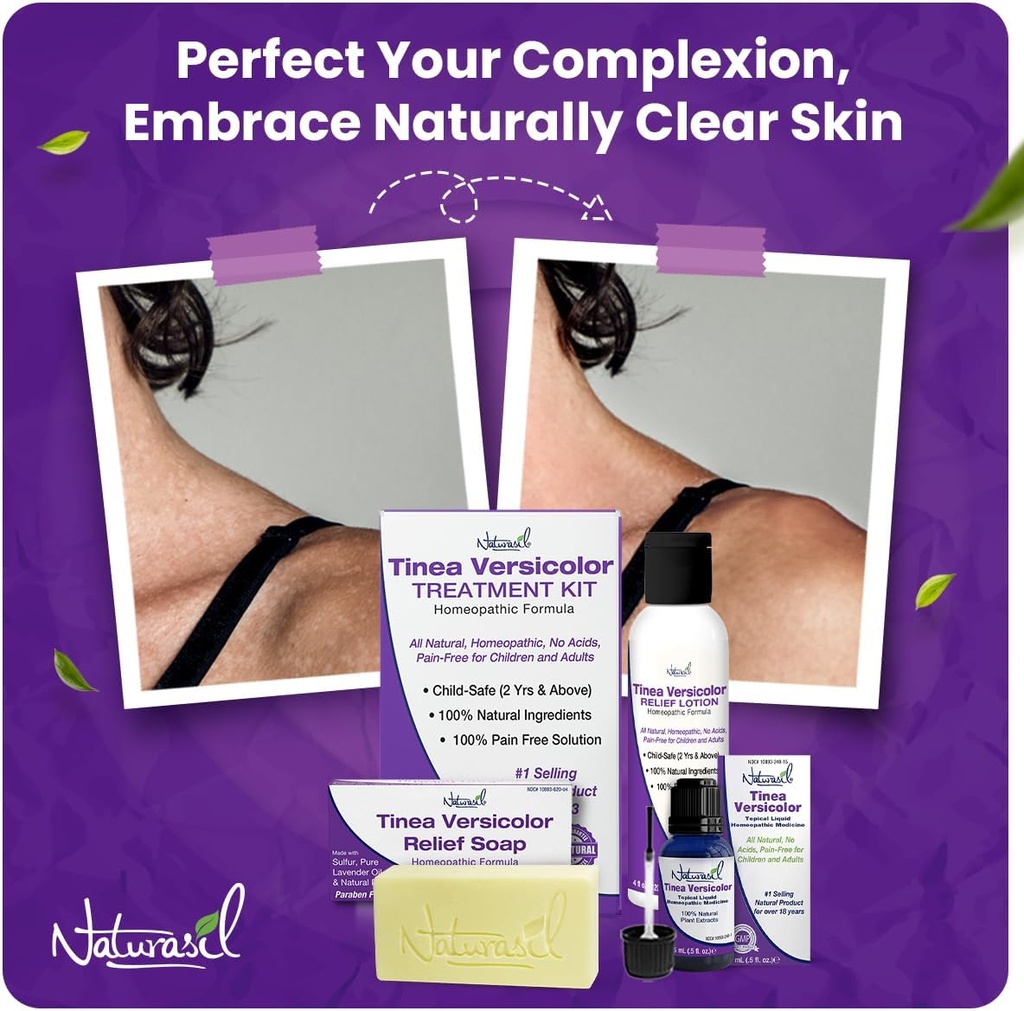 naturasil-antifungal-tinea-versicolor-tr-2.jpg