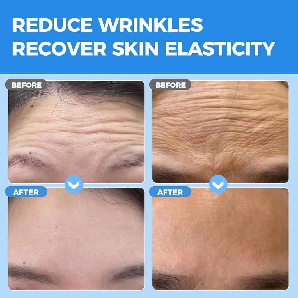 okela-forehead-wrinkle-patches-overnight-2.jpg