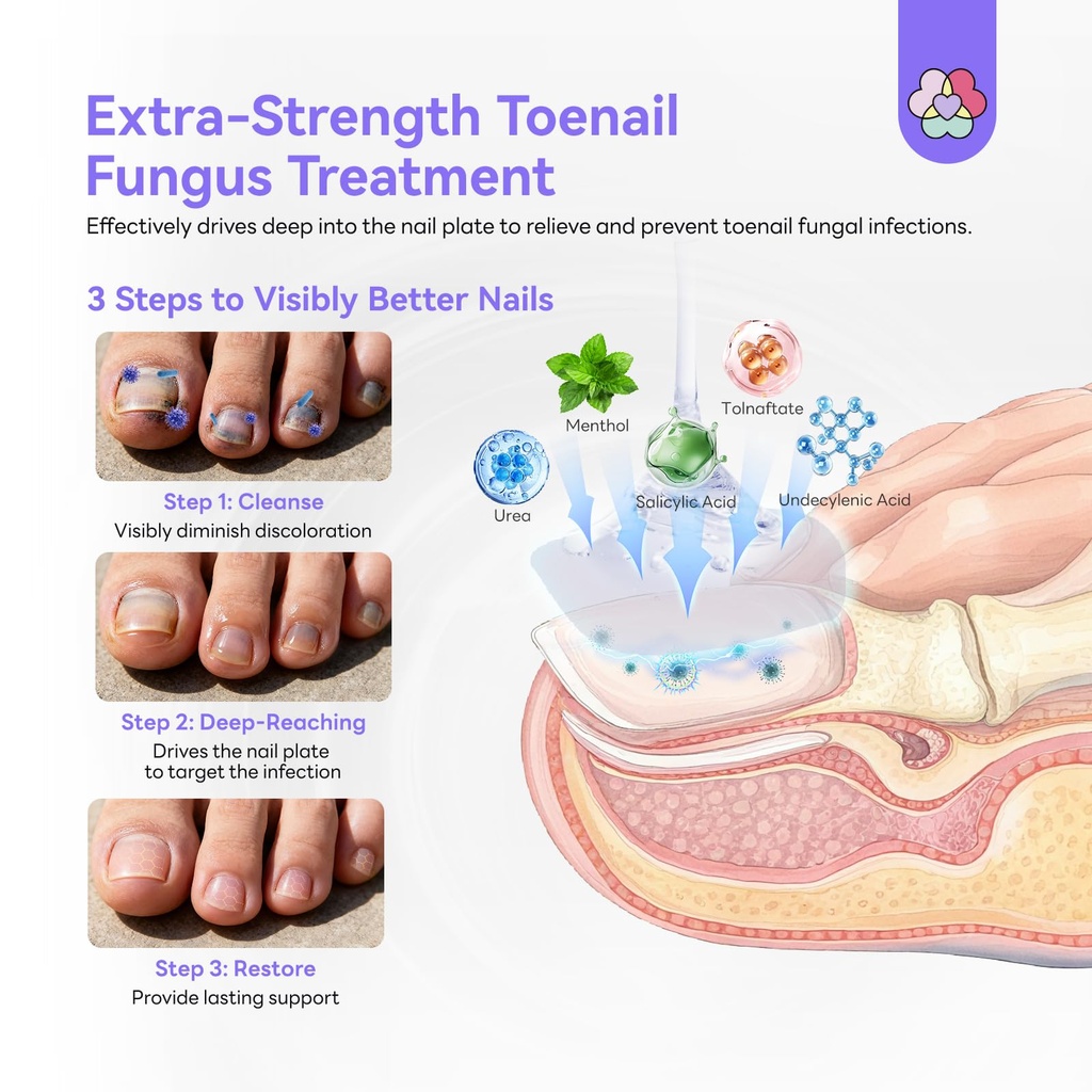 saviland-toenail-fungus-treatment-extra--4.jpg