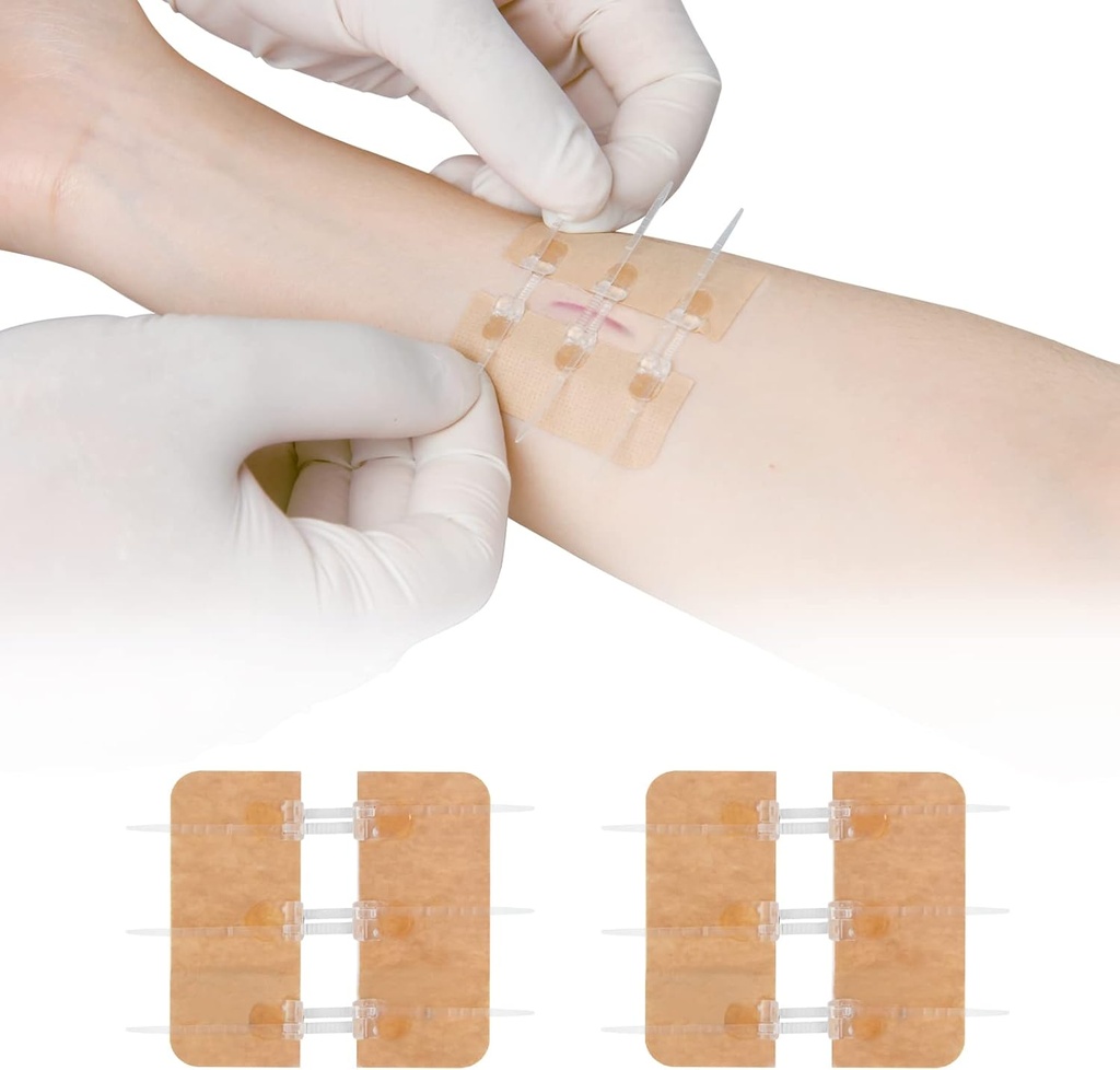 Perbaikan Lacturation Zip Stacgered Witches Butterfly Bandaids Quick Clot - Perangkat Pendekatan Luka Darurat 2 Potongan PU