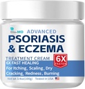 Bio-MD Psoriasis Eczema Cream, Eczema Cream for Dewasa, Extra Power Control Reaccection, Relieve Symptom of Resistant, Efektif untuk Sebordeciic Dermatitis, Tretment Folliculitis