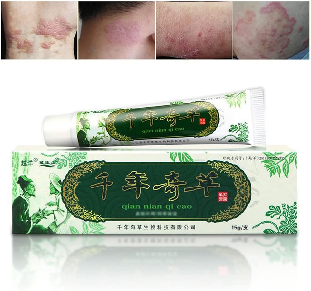 Oversea Herbal Cream China Herbal Ecsim, Psoriasis Cream Dermatitis dan Eczema Pruritus Psoriasis JIULIN OVER