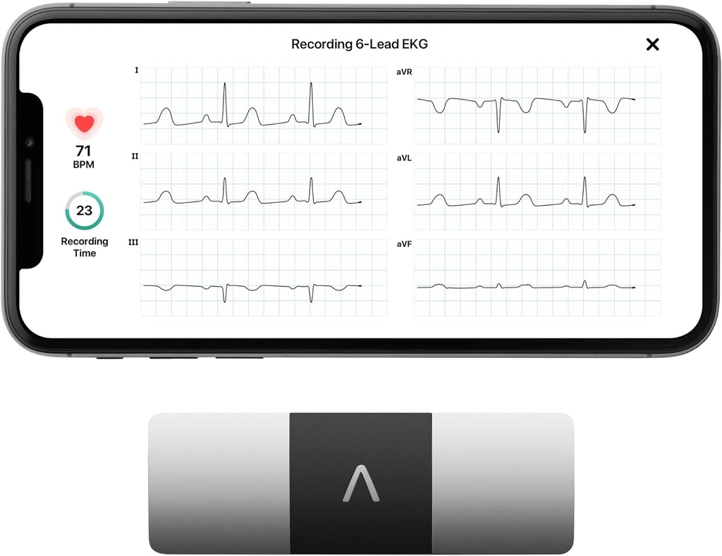 AliveCor KardiaMobile 6-Lead Personal EKG Monitor - Six View of The Heart - Deteksi AFib dan Irregular Arithmias - Hasil instan dalam 30 Detik - Bekerja dengan sebagian besar Smartphones