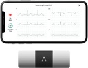 AliveCor KardiaMobile 6-Lead Personal EKG Monitor - Six View of The Heart - Deteksi AFib dan Irregular Arithmias - Hasil instan dalam 30 Detik - Bekerja dengan sebagian besar Smartphones