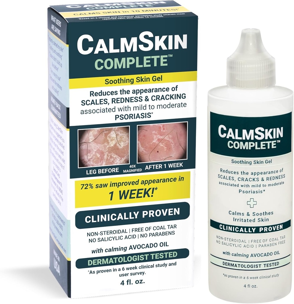 Xenna CalmSkin Complete 124; Clinically Proven to Soothe Irroated Skin dan Impreve The Applectures of Skin with Mild to Moderate Psoriasis 124; Made in The USA 144; 4 Flz.