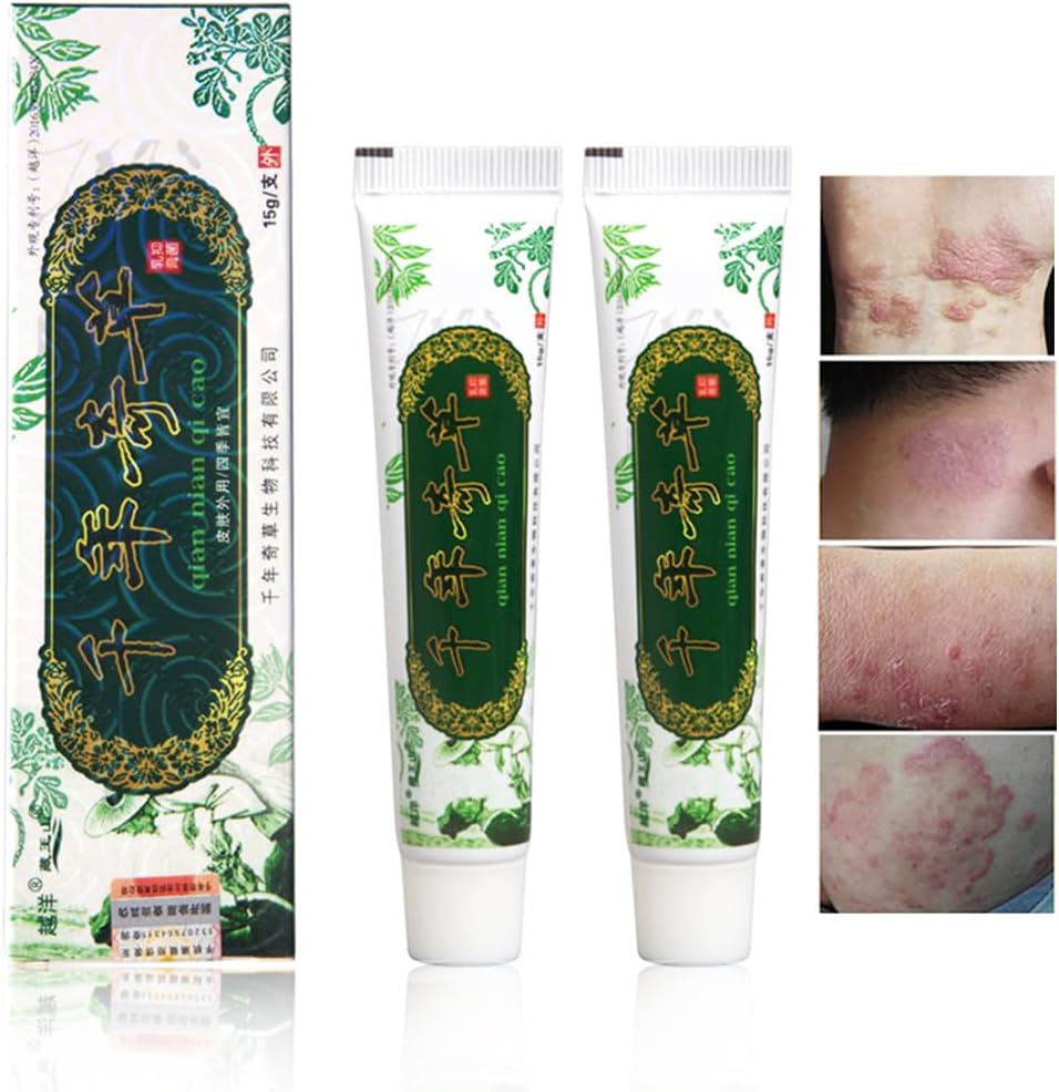 Oversea Herbal Cream Chinese Herbal Ecsim, Psoriasis Cream Dermatitis dan Eczema Pruritus Psoriasis JIULIN Outher (2PCS)