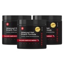 iRestore Advanced Growth Supplement for Women, Hair Vitamin for Faster Hair Regrowth, Best for Hair Loss and Thinning - 1 Monday Supply - 30 Count (Paket 3) - Black