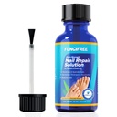 Perawatan Toenail Fungus Ekstra Kekuatan-Nail Fungus Pengobatan untuk Perlakuan Toenail-ToeNail Pengobatan Ekstra Kekuatan-Nail Jamur (30ml)