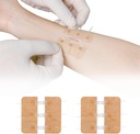 Perbaikan Lacturation Zip Stacgered Witches Butterfly Bandaids Quick Clot - Perangkat Pendekatan Luka Darurat 2 Potongan PU