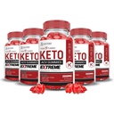 Laboratorium Sesak (5 Kemy Tummy Tako ACV Ekstrim 2000MG Tummy Keto Printo Apple Cider Vinegar Terbuat dengan Pelopate Beet Juice Powder B12 Vegan