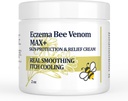 High Strength Bee Venom Cream, Dyshidrotic Eczema Ocondities, Heat Rash, Itching, Eczema, Psoriasis, Leg, Stomach, Foot, Hand, Irroited Skin, All Age Care
