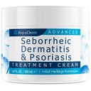 Roycederm Seborrhecic Dermatitis Cream, Scalp Treatment for Psoriasis, Folliculitis, Dry Scapp, Dandruff, Anti- Itch Cream for Sootful Relief