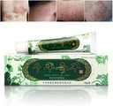 Oversea Herbal Cream China Herbal Ecsim, Psoriasis Cream Dermatitis dan Eczema Pruritus Psoriasis JIULIN OVER
