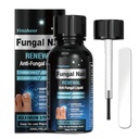 Perawatan Toenail Fungus, Perawatan Nail Fungus untuk Toenail, Solution Repair Nail, Liquid Renewal Fingernageed untuk Nail, Obat Nail Fungus, Aman dan Lembut - 30ML (1 FLOZ)