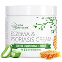 Hiburan liar Eczema & Psoriasis Cream untuk Dry, Itchy Skin - Eczema Relief untuk Dewasa & Anak-anak - Moisturizing Psoriasis Cream dengan Manuka Honey
