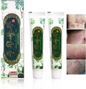 Oversea Herbal Cream Chinese Herbal Ecsim, Psoriasis Cream Dermatitis dan Eczema Pruritus Psoriasis JIULIN Outher (2PCS)